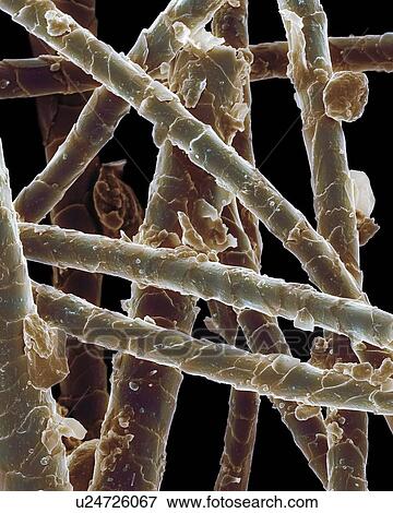 Stock Photo - Dander on dog hair, SEM. Fotosearch