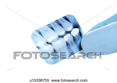 Dental X-ray View Large Photo Image Stock Photography - Dental X-ray. Fotosearch