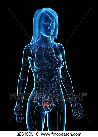 Stock Photograph - Diseased bladder, illustration. Fotosearch
