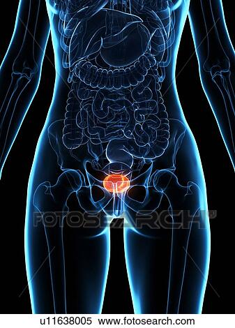 Stock Photography - Diseased bladder, illustration. Fotosearch