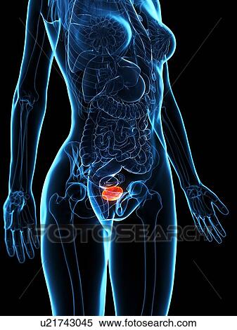 Stock Photography - Diseased bladder, illustration. Fotosearch