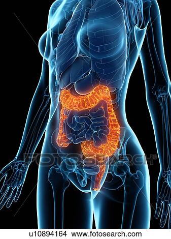 Diseased colon, illustration View Large Photo Image Picture - Diseased colon, illustration. Fotosearch