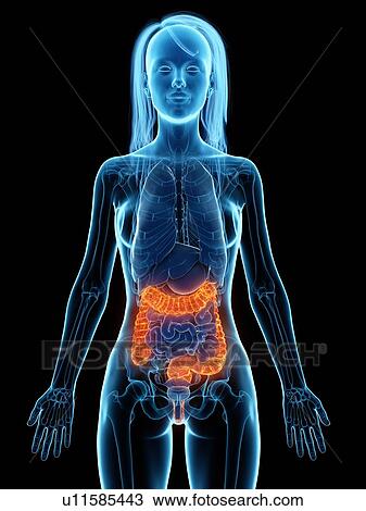 Stock Image - Diseased colon, illustration. Fotosearch