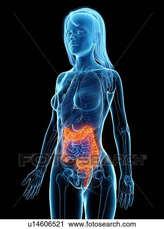 Diseased colon, illustration View Large Photo Image Stock Image - Diseased colon, illustration. Fotosearch