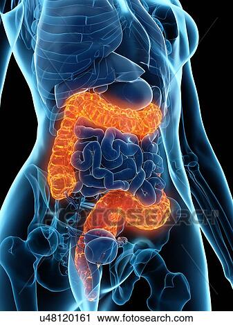 Stock Image - Diseased colon, illustration. Fotosearch