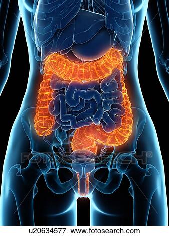 Diseased colon, illustration View Large Photo Image Stock Photo - Diseased colon, illustration. Fotosearch