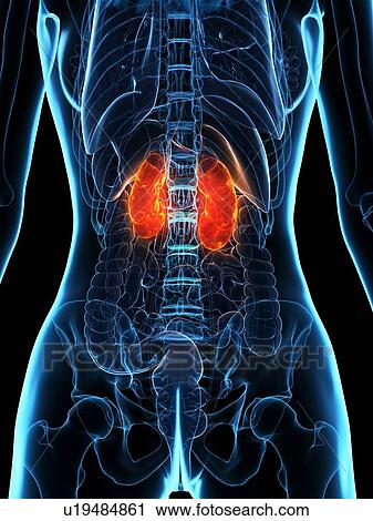Diseased kidneys, conceptual illustration View Large Photo Image Stock Image - Diseased kidneys, conceptual illustration. Fotosearch