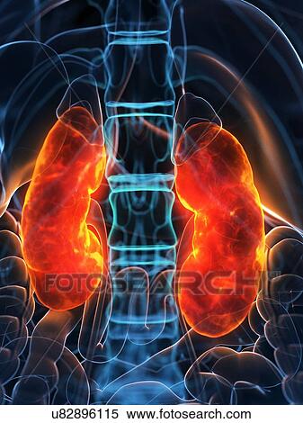 Stock Photography - Diseased kidneys, conceptual illustration. Fotosearch