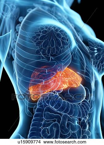 Picture - Diseased liver, illustration. Fotosearch