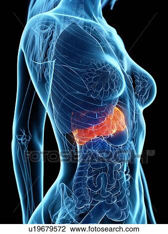 Stock Image - Diseased liver, illustration. Fotosearch