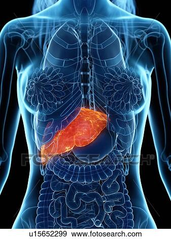 Stock Photo - Diseased liver, illustration. Fotosearch