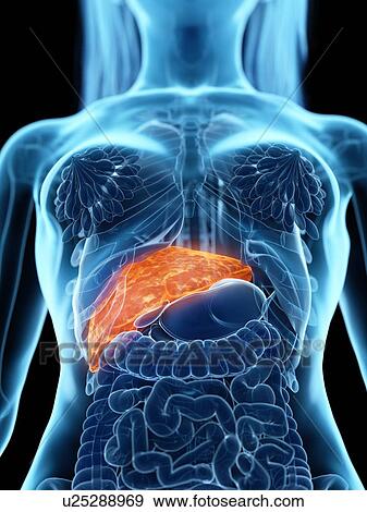 Stock Photo - Diseased liver, illustration. Fotosearch