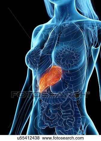 Stock Photo - Diseased liver, illustration. Fotosearch