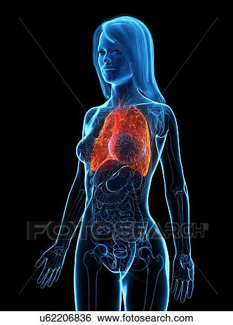 Stock Photograph - Diseased lung, illustration. Fotosearch