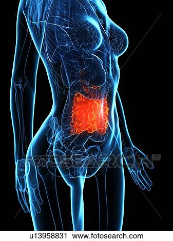 Stock Image - Diseased small intestine, illustration. Fotosearch