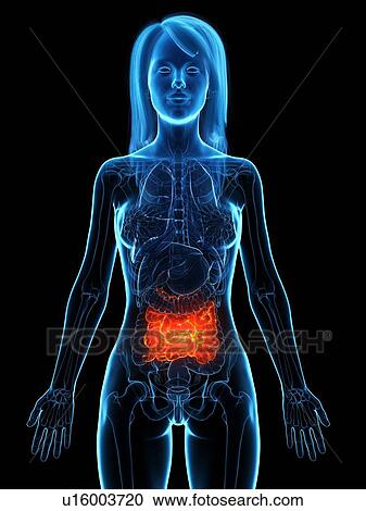 Diseased small intestine, illustration View Large Photo Image Stock Image - Diseased small intestine, illustration. Fotosearch
