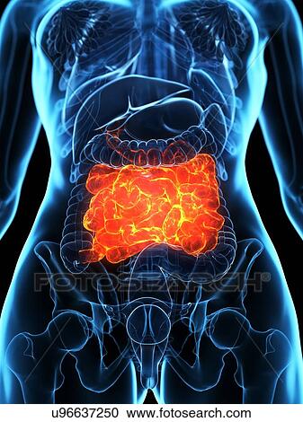 Diseased small intestine, illustration View Large Photo Image Stock Image - Diseased small intestine, illustration. Fotosearch