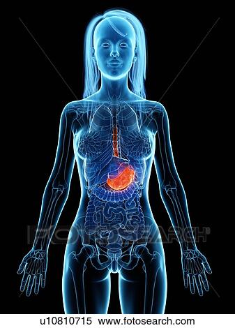 Stock Photography - Diseased stomach, illustration. Fotosearch