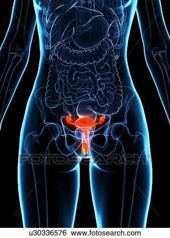 Diseased uterus, illustration View Large Photo Image Stock Photograph - Diseased uterus, illustration. Fotosearch