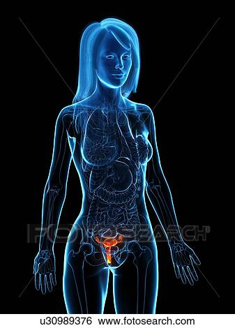 Stock Photograph - Diseased uterus, illustration. Fotosearch