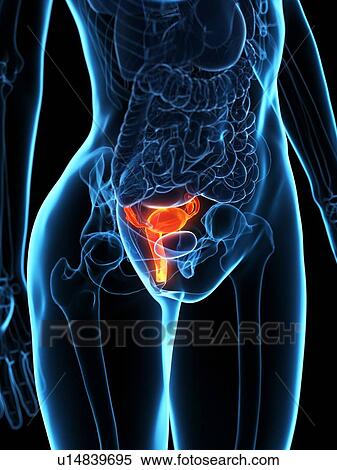 Diseased uterus, illustration View Large Photo Image Stock Photography - Diseased uterus, illustration. Fotosearch