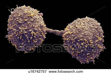 Stock Photo - Dividing prostate cancer cells, SEM. Fotosearch