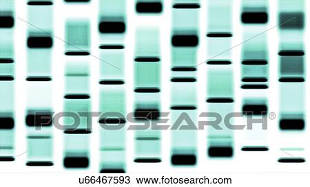 Stock Image - DNA autoradiograph, illustration. Fotosearch