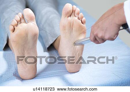 Doctor testing patient's plantar reflex View Large Photo Image Stock Image - Doctor testing patient's plantar reflex. Fotosearch