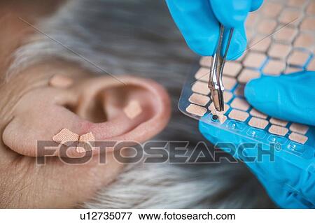 Ear acupuncture point therapy View Large Photo Image Stock Photo - Ear acupuncture point therapy. Fotosearch