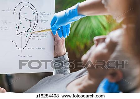 Ear acupuncture point therapy View Large Photo Image Stock Photo - Ear acupuncture point therapy. Fotosearch