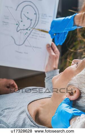 Stock Photo - Ear acupuncture point therapy. Fotosearch