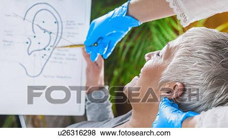 Stock Photo - Ear acupuncture point therapy. Fotosearch
