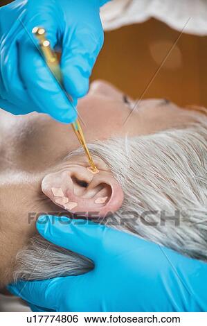 Ear acupuncture point therapy View Large Photo Image Stock Photograph - Ear acupuncture point therapy. Fotosearch