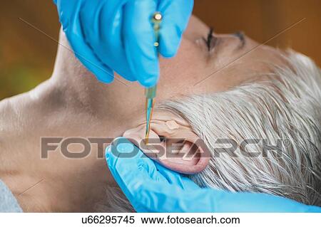 Stock Photography - Ear acupuncture point therapy. Fotosearch