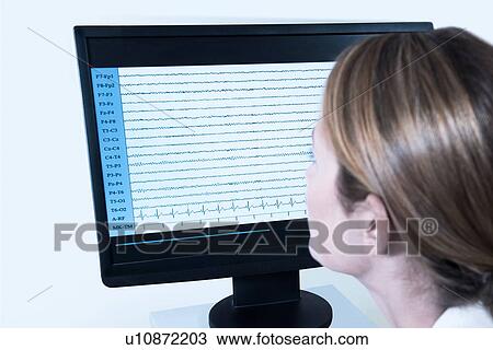 Stock Image - EEG analysis. Fotosearch