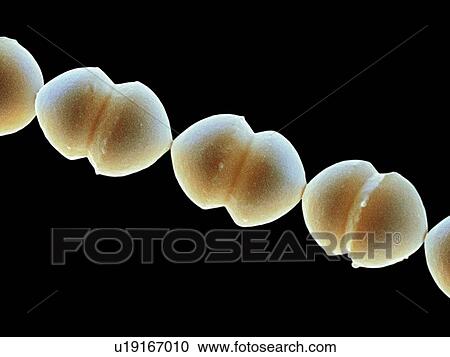 Enterococcus faecalis, SEM View Large Photo Image Stock Image - Enterococcus faecalis, SEM. Fotosearch