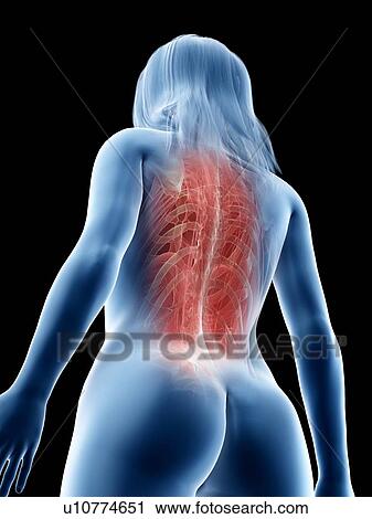 Stock Image - Female back muscles, illustration. Fotosearch