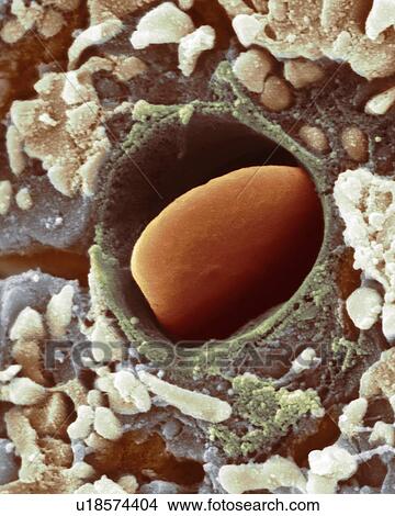 Picture - Heart capillary, SEM. Fotosearch