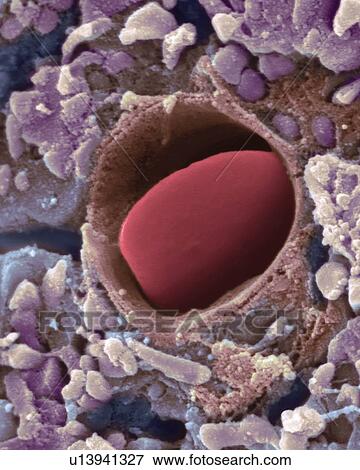 Heart capillary, SEM View Large Photo Image Stock Photo - Heart capillary, SEM. Fotosearch