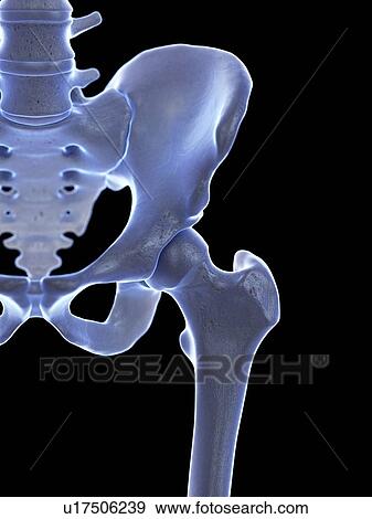Stock Photo - Hip joint, illustration. Fotosearch