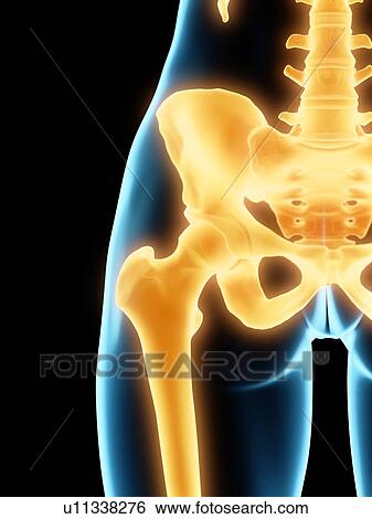 Stock Photograph - Hip joint, illustration. Fotosearch