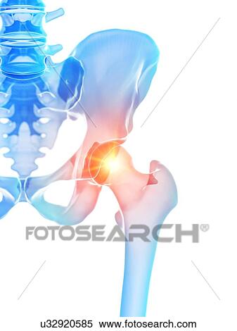 Hip pain, conceptual illustration View Large Photo Image Stock Photography - Hip pain, conceptual illustration. Fotosearch