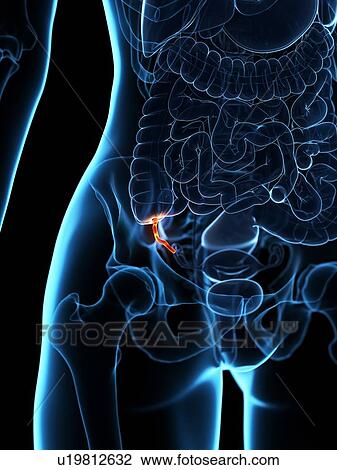 Inflamed appendix, conceptual illustration View Large Photo Image Stock Image - Inflamed appendix, conceptual illustration. Fotosearch