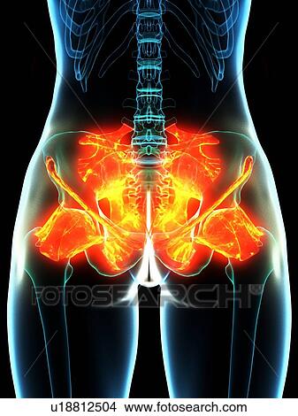 Inflamed ligaments, conceptual illustration View Large Photo Image Picture - Inflamed ligaments, conceptual illustration. Fotosearch