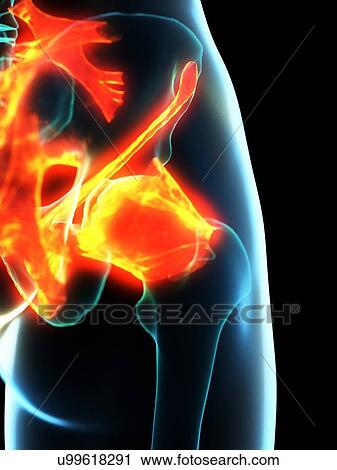 Inflamed ligaments, conceptual illustration View Large Photo Image Stock Image - Inflamed ligaments, conceptual illustration. Fotosearch