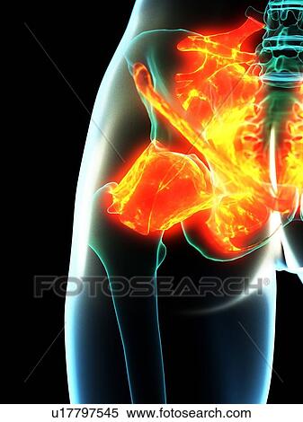 Inflamed ligaments, conceptual illustration View Large Photo Image Stock Photography - Inflamed ligaments, conceptual illustration. Fotosearch
