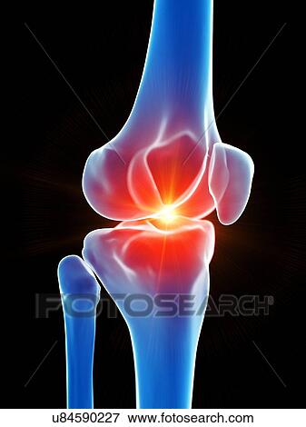 Knee pain, conceptual illustration View Large Photo Image Stock Photo - Knee pain, conceptual illustration. Fotosearch