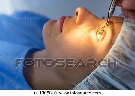 Stock Image - Laser eye surgery. Fotosearch