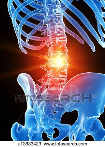 Lumbar pain, conceptual illustration View Large Photo Image Stock Image - Lumbar pain, conceptual illustration. Fotosearch