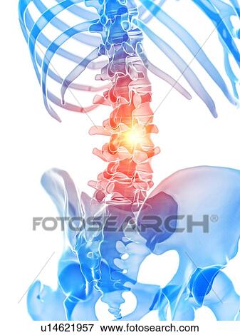 Lumbar pain, conceptual illustration View Large Photo Image Stock Photo - Lumbar pain, conceptual illustration. Fotosearch